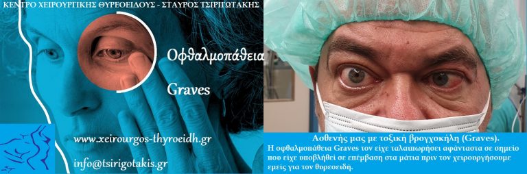 νόσος Γκρέϊβς εξόφθαλμο